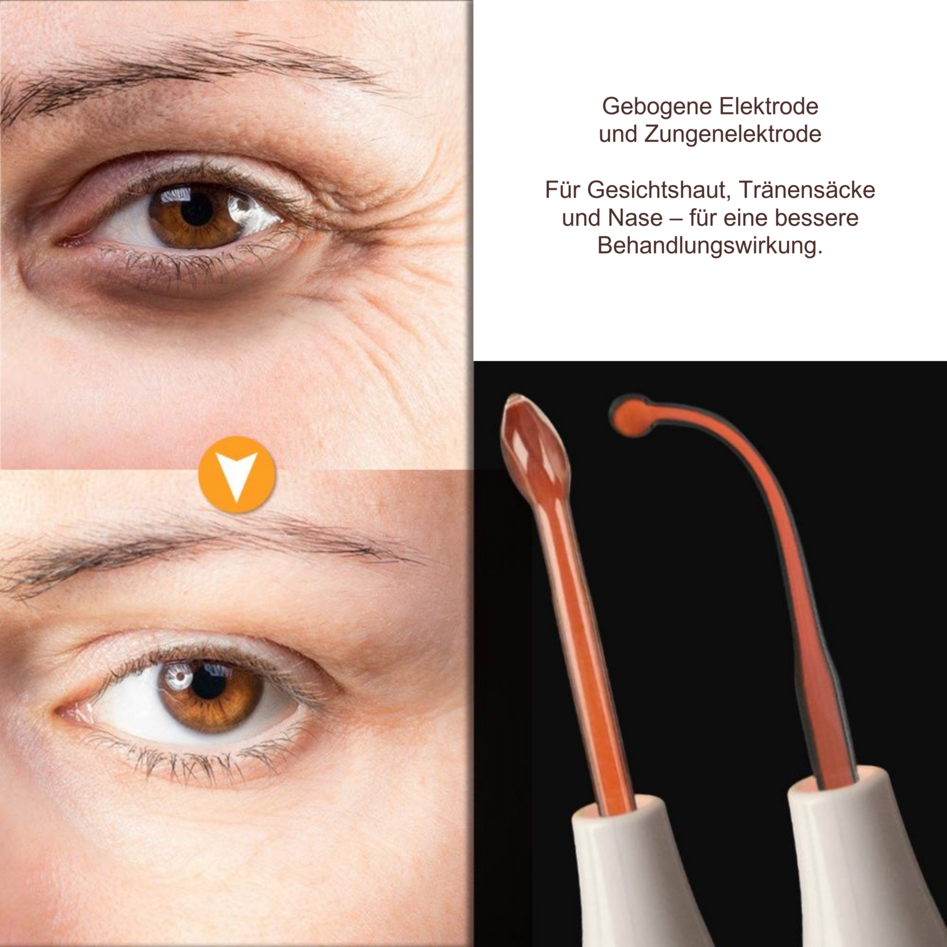 4-in-1 Hochfrequenzstab, Anti-Aging-Gerät – Gebogene Elektroden mit Vergleich der Augenpartie