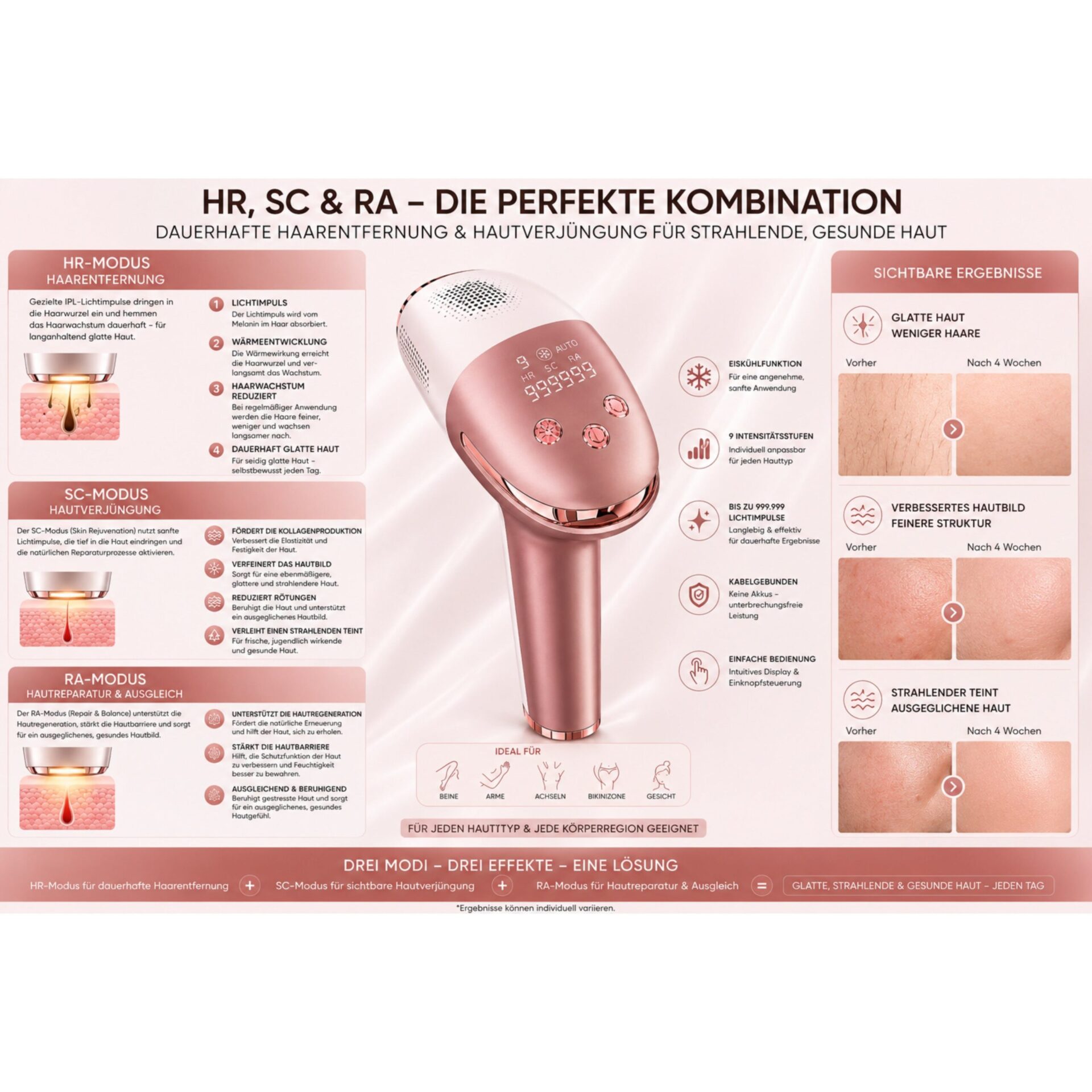 IPL-Haarentferner IceSilk Pro mit Eiskühlfunktion, HR/SC/RA & Auto-Modus – HR-, SC- und RA-Modi mit Hautschemata