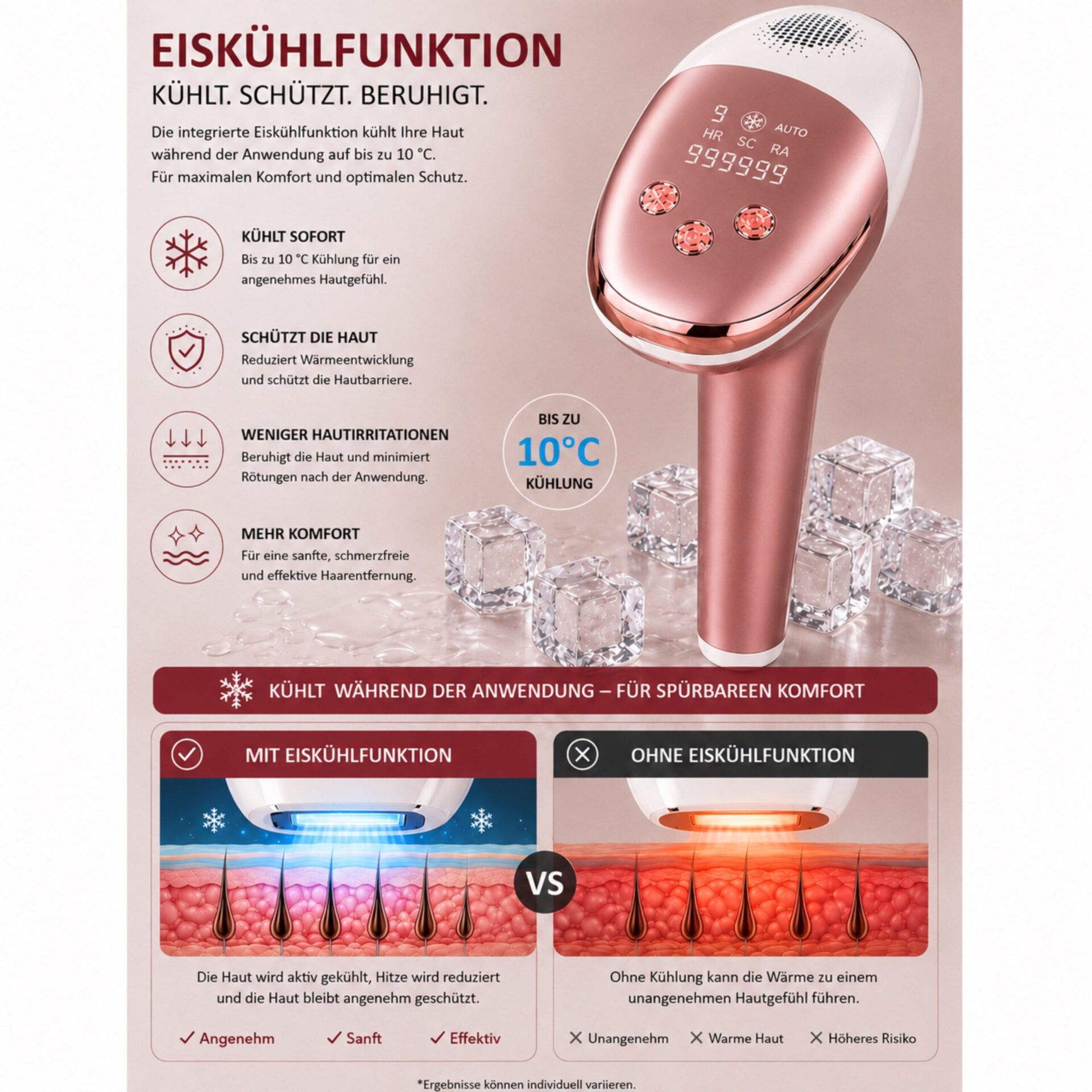 IPL-Haarentferner IceSilk Pro mit Eiskühlfunktion, HR/SC/RA & Auto-Modus – Eiskühlfläche und Hautkontakt im Vergleich