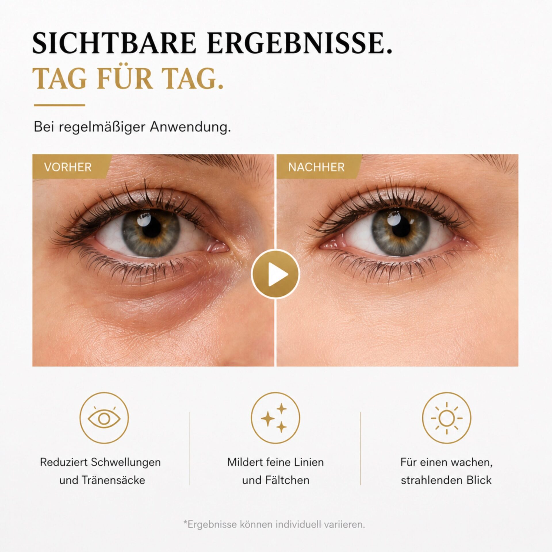 Gesichtsmassagegerät LUMIÉRA EyeLift Pro Augenmassagegerät mit Rotlicht & Mikrostrom – Augenpartie im Detail